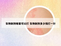 生物制剂哪里可以打 生物制剂多少钱打一针