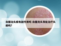 白醋治头癣有副作用吗 白醋洗头发能治疗头癣吗?