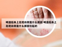 喝酒后身上出现白斑是什么原因 喝酒后身上出现白斑是什么原因引起的