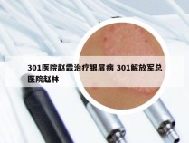 301医院赵霖治疗银屑病 301解放军总医院赵林