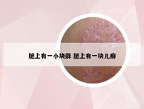 腿上有一小块藓 腿上有一块儿癣