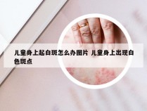 儿童身上起白斑怎么办图片 儿童身上出现白色斑点