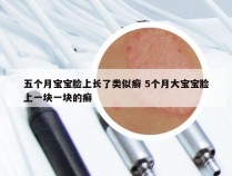 五个月宝宝脸上长了类似癣 5个月大宝宝脸上一块一块的癣