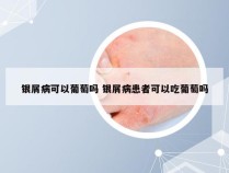 银屑病可以葡萄吗 银屑病患者可以吃葡萄吗