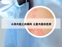 小孩大腿上白癜风 儿童大腿白色斑