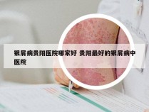 银屑病贵阳医院哪家好 贵阳最好的银屑病中医院