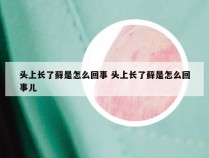 头上长了藓是怎么回事 头上长了藓是怎么回事儿