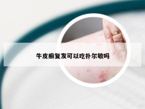 牛皮癣复发可以吃扑尔敏吗