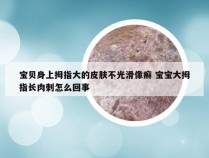 宝贝身上拇指大的皮肤不光滑像癣 宝宝大拇指长肉刺怎么回事