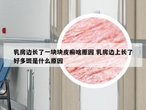 乳房边长了一块块皮癣啥原因 乳房边上长了好多斑是什么原因