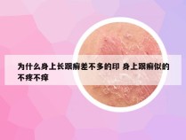 为什么身上长跟癣差不多的印 身上跟癣似的不疼不痒