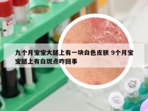 九个月宝宝大腿上有一块白色皮肤 9个月宝宝腿上有白斑点咋回事