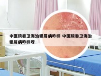 中医院娄卫海治银屑病咋样 中医院娄卫海治银屑病咋样呀