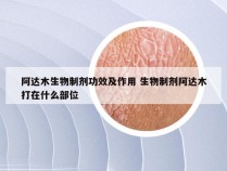 阿达木生物制剂功效及作用 生物制剂阿达木打在什么部位