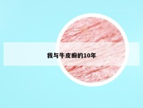 我与牛皮癣的10年