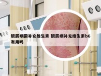 银屑病需补充维生素 银屑病补充维生素b6有用吗