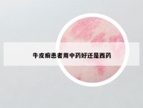 牛皮癣患者用中药好还是西药