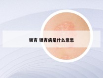 银宵 银宵病是什么意思