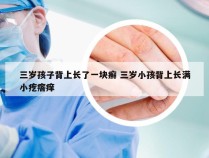 三岁孩子背上长了一块癣 三岁小孩背上长满小疙瘩痒