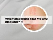 甲氨喋呤治疗副银屑病服用方法 甲氨蝶呤治银屑病的服用方法