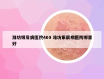 潍坊银屑病医院400 潍坊银屑病医院哪里好