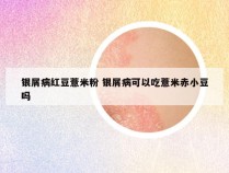 银屑病红豆薏米粉 银屑病可以吃薏米赤小豆吗