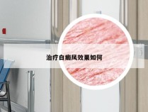 治疗白癜风效果如何