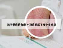 孩子俩肩膀有癣 小孩肩膀起了几个小点点