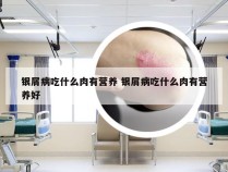 银屑病吃什么肉有营养 银屑病吃什么肉有营养好