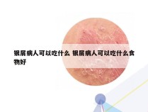 银屑病人可以吃什么 银屑病人可以吃什么食物好