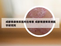 成都银康银屑医院在哪里 成都银康银屑病医学研究院