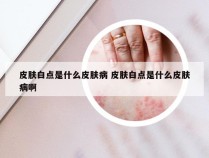 皮肤白点是什么皮肤病 皮肤白点是什么皮肤病啊