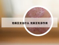 克癣王主治什么 克藓王乳膏作用