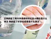 正胸前起了两大块像癣样的红色小颗粒是什么情况 胸前起了好多红疙瘩是什么情况