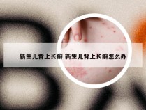 新生儿背上长癣 新生儿背上长癣怎么办