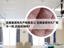 百癣夏塔热片产地黑龙江 百癣夏塔热片厂家不一样,药有区别吗?