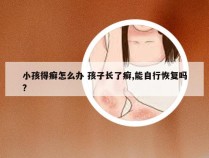 小孩得癣怎么办 孩子长了癣,能自行恢复吗?