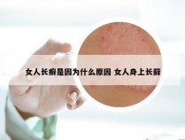 女人长癣是因为什么原因 女人身上长藓