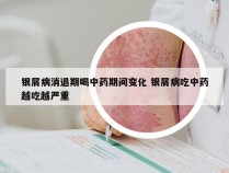 银屑病消退期喝中药期间变化 银屑病吃中药越吃越严重