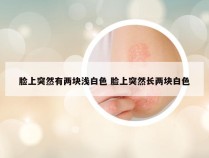 脸上突然有两块浅白色 脸上突然长两块白色