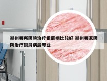 郑州哪所医院治疗银屑病比较好 郑州哪家医院治疗银屑病最专业