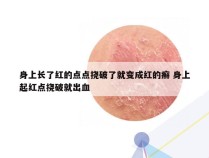 身上长了红的点点挠破了就变成红的癣 身上起红点挠破就出血