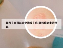 联邦廯克可以完全治疗廯吗 联邦癣克主治什么