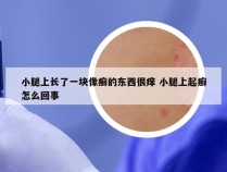 小腿上长了一块像癣的东西很痒 小腿上起癣怎么回事