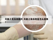 大腿上出白斑图片 大腿上有白斑是怎么回事?