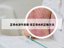 正骨水涂牛皮癣 搽正骨水的正确方法