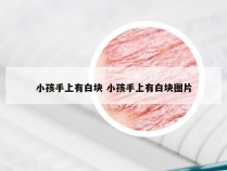 小孩手上有白块 小孩手上有白块图片