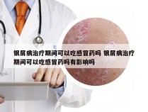 银屑病治疗期间可以吃感冒药吗 银屑病治疗期间可以吃感冒药吗有影响吗