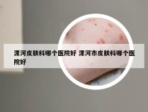 漯河皮肤科哪个医院好 漯河市皮肤科哪个医院好