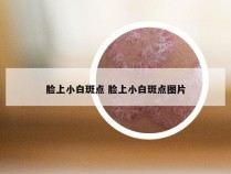 脸上小白斑点 脸上小白斑点图片